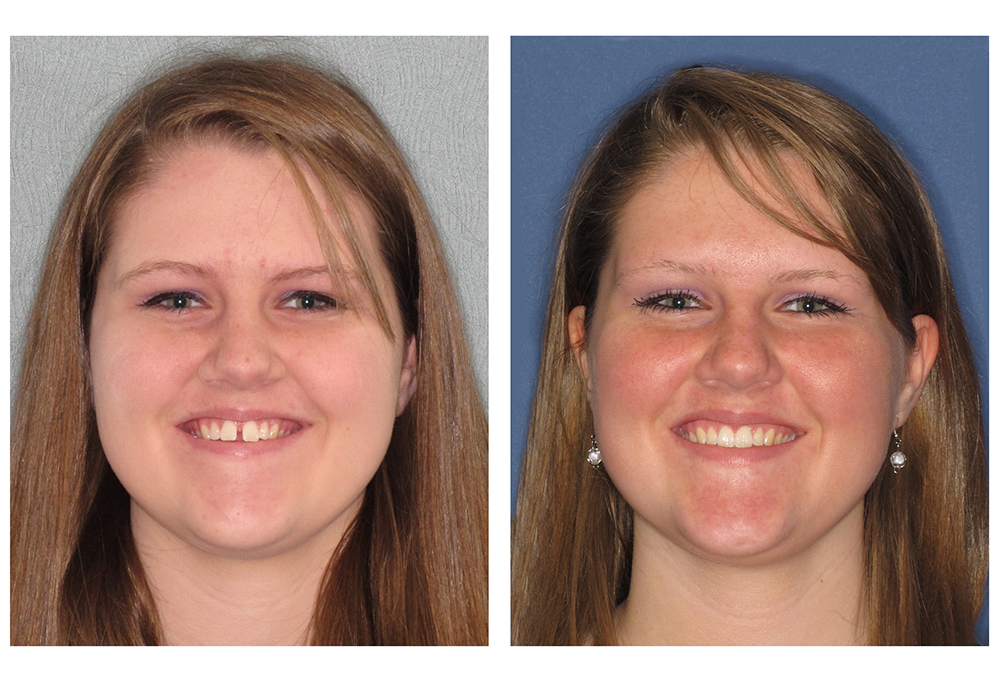 iSmile Dental