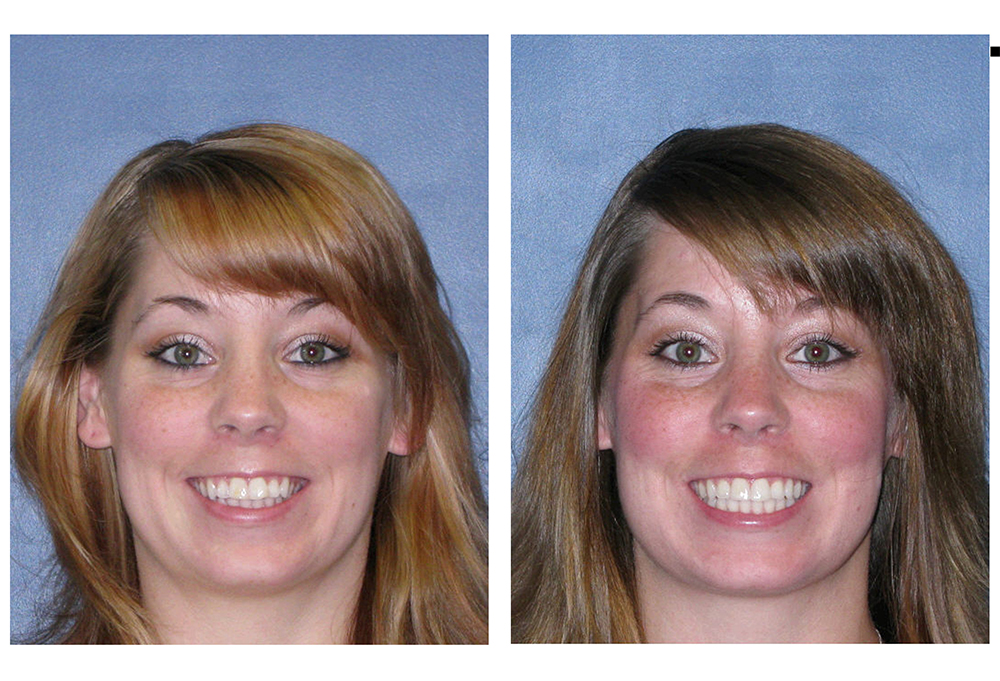 iSmile Dental