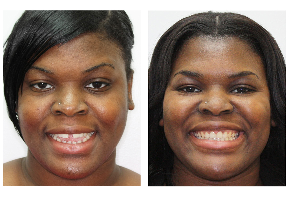 iSmile Dental