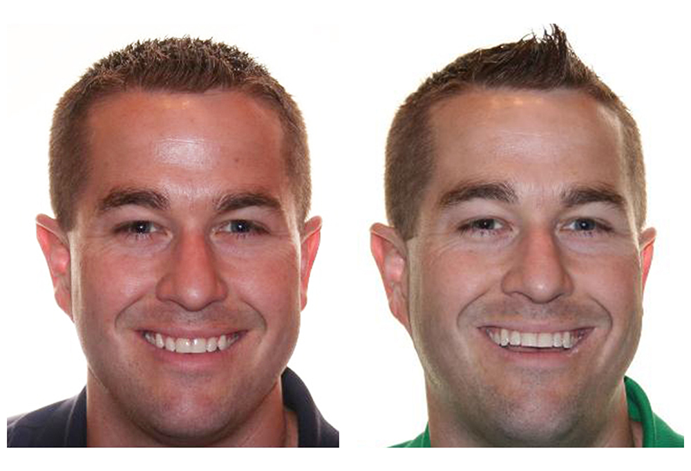 iSmile Dental
