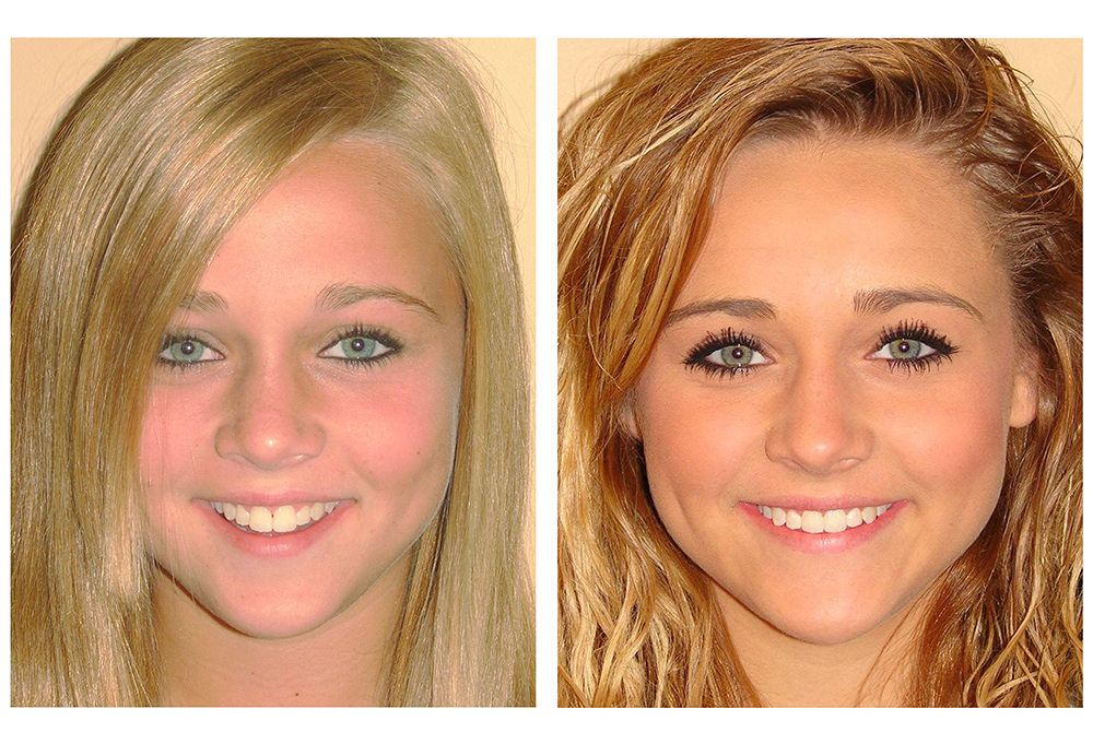 iSmile Dental
