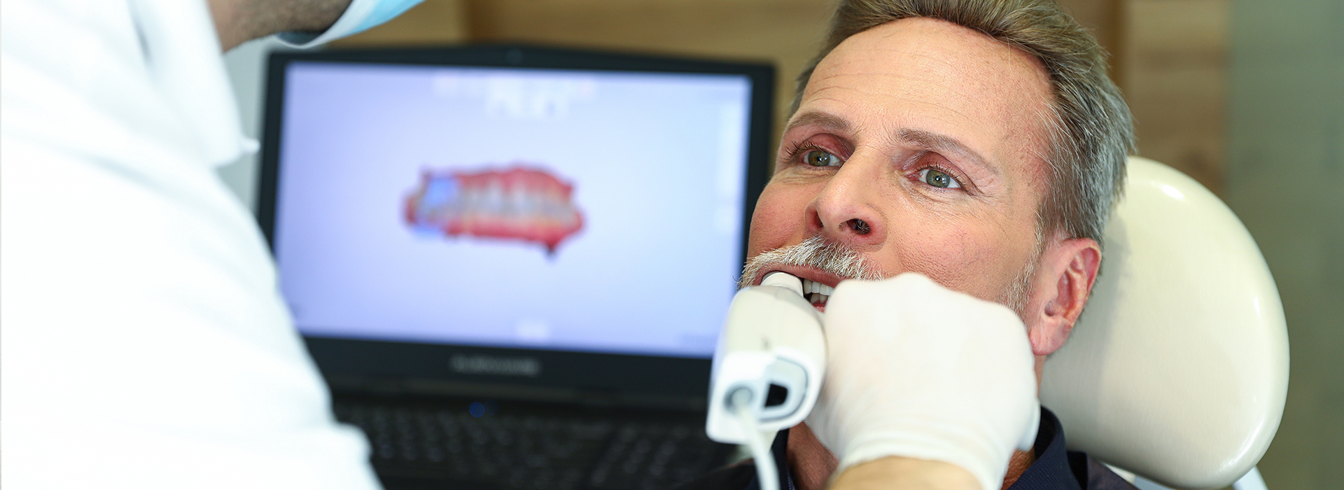 iSmile Dental | All-on-6 reg , Implant Dentistry and Implant Restorations