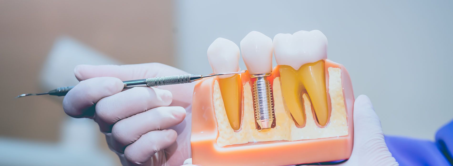 iSmile Dental | Invisalign reg , Ceramic Crowns and Dermal Fillers