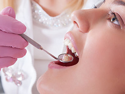 A dental professional performing a procedure on a patient's teeth, using a dental drill and a dental mirror.